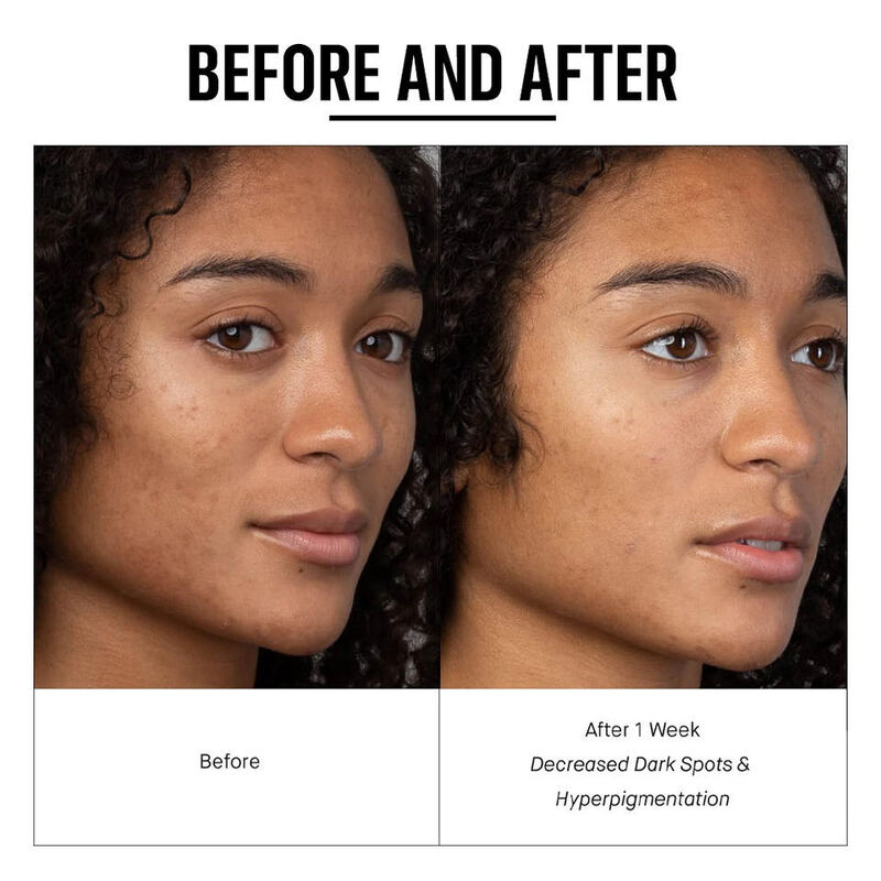 OEM ODM brand customized serum organic nicotinamide essence whitening brightening spot removing facial essence