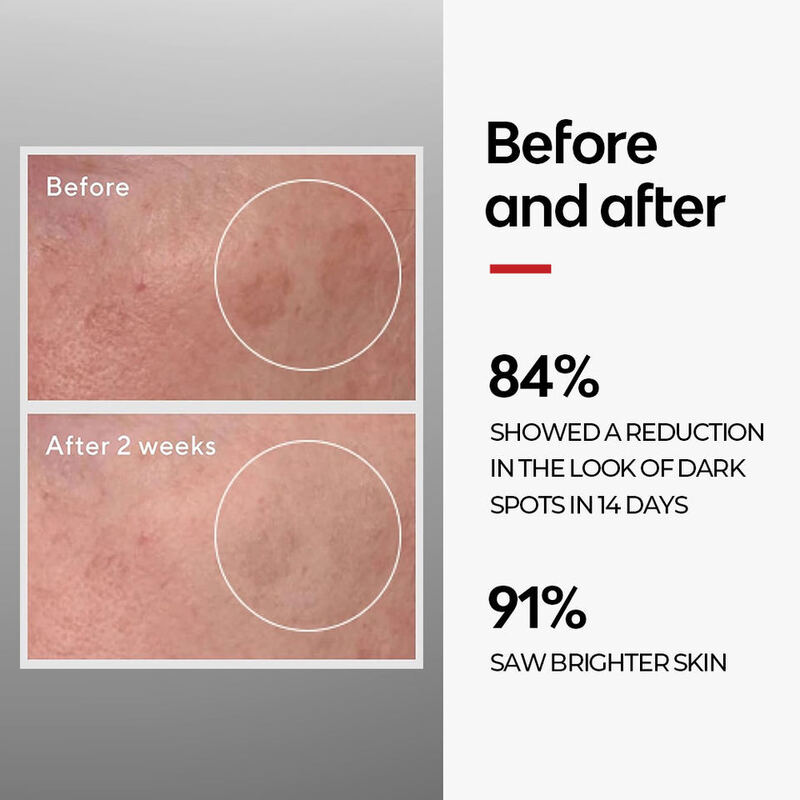 OEM ODM brand 40% VCIP Niacinemide skin care set anti-aging facial serum skin care product whitening anti wrinkle pore shrink facial essence face cream facial cleanser