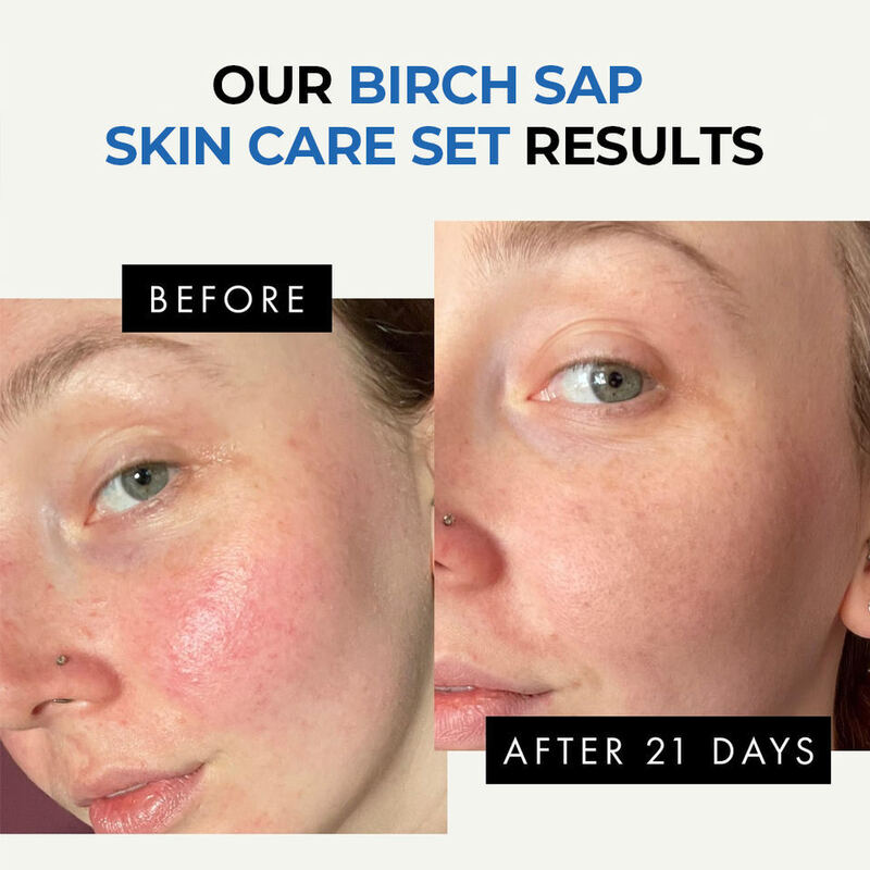 OEM ODM Brand Skin Care Set Natural Birch Juice Facial Serum Sensitive Skin Care Face Cream Collagen Anti aging Moisturizing Reddening Skin Toner Cleanser Facial Cleanser
