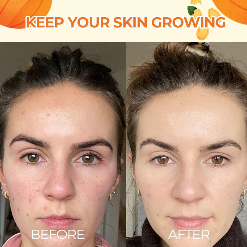 OEM ODM customized pure skin care essence skin care product pumpkin rose anti-aging wrinkle whitening acne removing serum