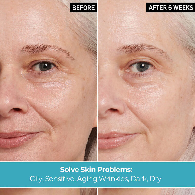 OEM ODM 5 in 1 face cream Natural skin care whitening anti-aging wrinkle brightening face cream