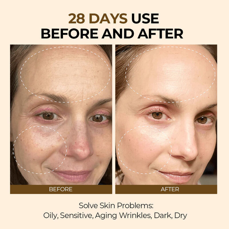OEM ODM Korean Organic Skin Care 5 in 1 Urosin Collagen Anti aging Whitening Skin Brightening face cream