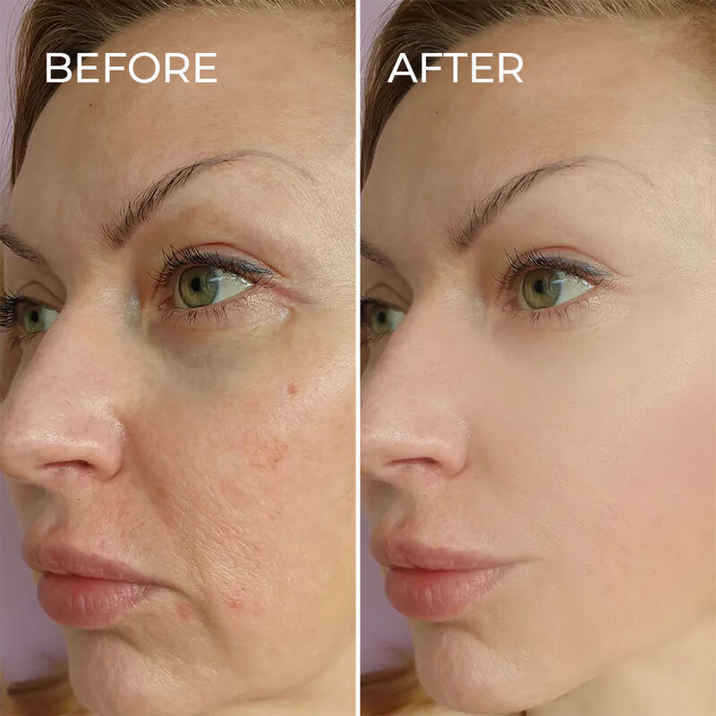 OEM ODM brand skin care anti-aging facial serum hyaluronic acid moisturizing peptide essence whitening facial face cream toner beauty facial mask set