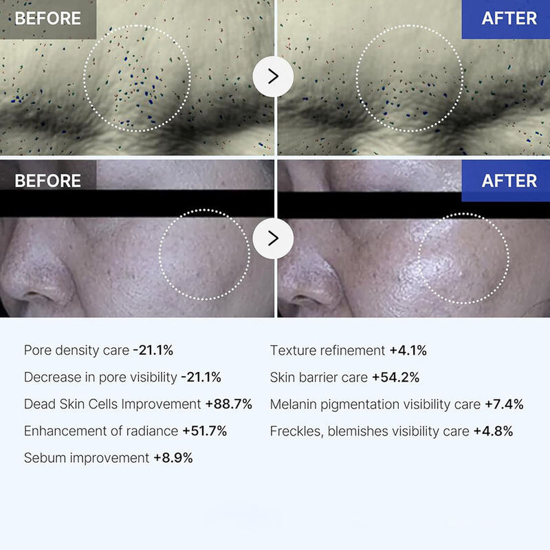OEM ODM brand skin care products Anti aging anti wrinkle facial shrinking pores Exosomes skin care facial essence whitening skin care