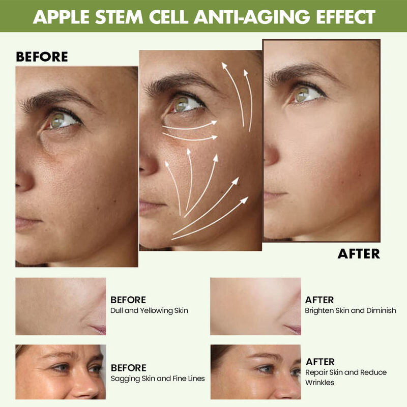 OEM ODM Korean brand organic skin care product set anti fine lines and wrinkles firming essence to enhance apple stem cell facial moisturizing cream