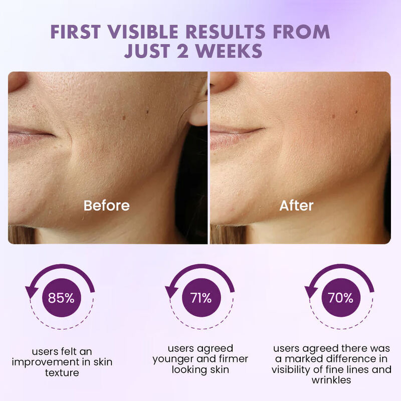 OEM ODM brand beauty products collagen peptides retinol facial serum skincare whitening hydration anti-aging facial serum