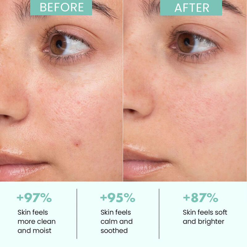 OEM ODM Acne Skin Cleanser Mild Amino Acid Deep Cleaning Makeup Removing foam Facial Cleanser Beauty Care