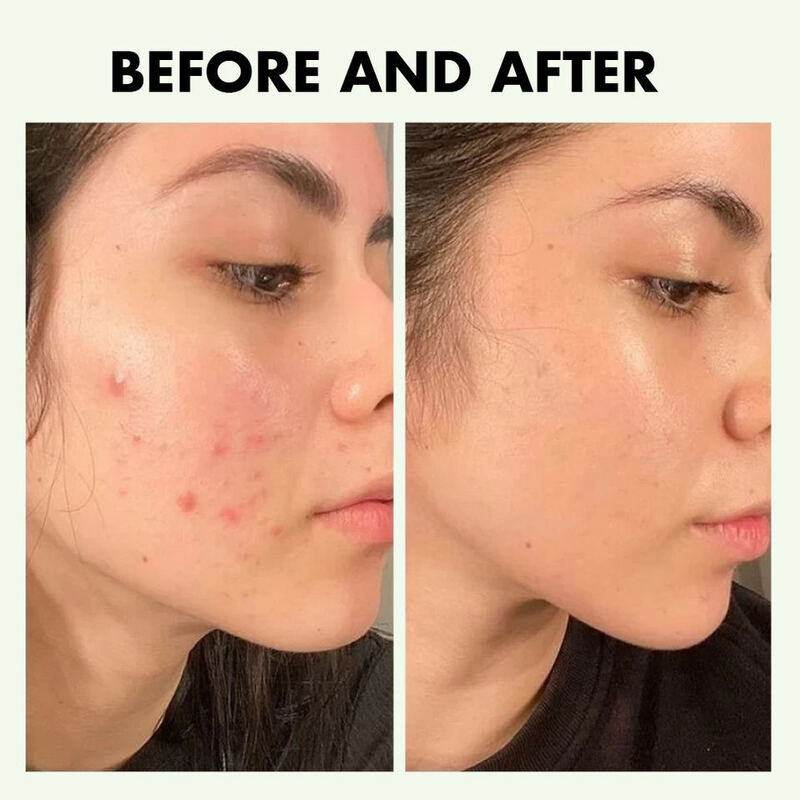 OEM ODM Organic Cleansing gel Mild Moisturizing Makeup Removing Acne Skin Friendly Cleansing Jelly Cleanser