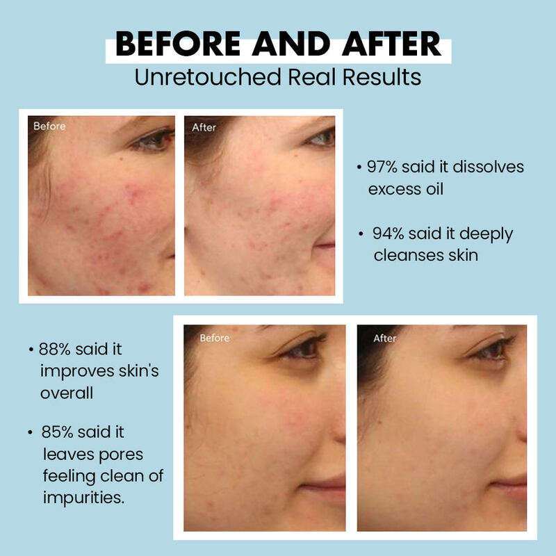 OEM ODM Brand Organic Cleansing gel Mild Moisturizing Acne Skin Care Makeup Removing Cleanser Jelly Facial Cleanser