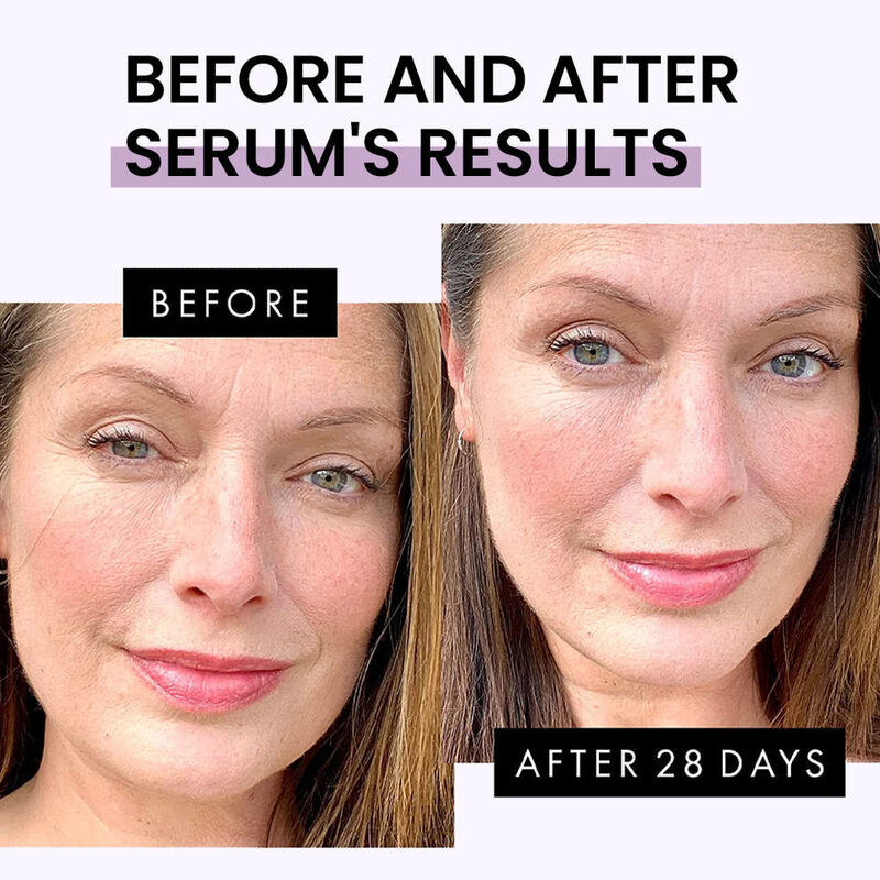 OEM ODM brand vegetarian serum skin care product anti-aging, reducing wrinkles, tightening, improving facial firmness, female facial essence