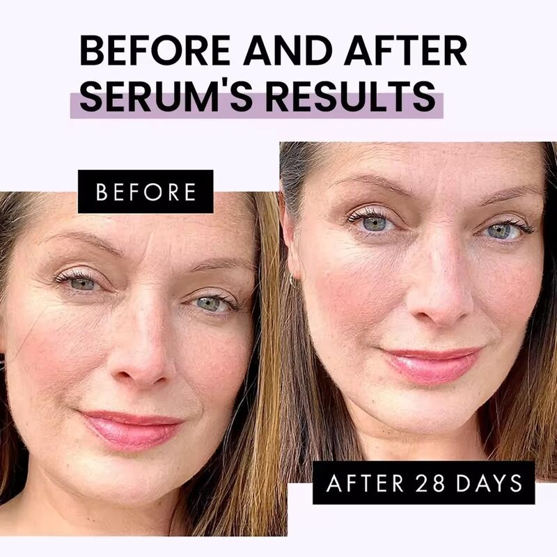OEM ODM Cosmetics Beauty Vegetarian Serum Skin Care Products Whitening Skin Brightening Vitamin C Face essence