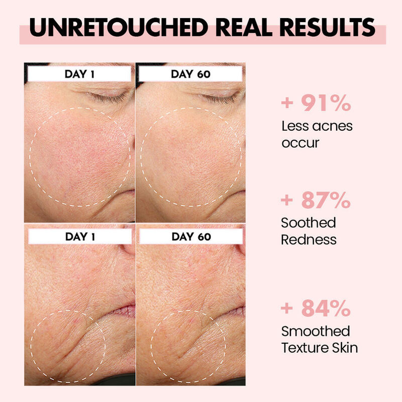 OEM ODM Vegetarian face cream Anti aging Whitening Retinol Niacinamide Glycerin Facial Moisturizing&Moisturizing Skin Care Cream