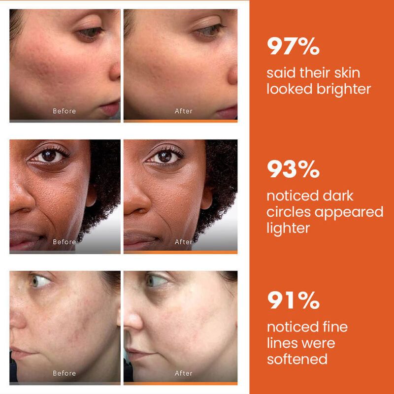 OEM ODM brand customized skin care serum product whitening black spot remover carrot turmeric facial essence