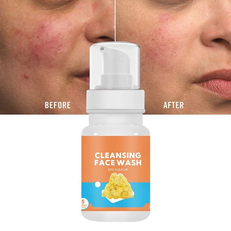 OEM ODM Korean brand facial cleanser sulfur whitening and acne treatment oil control cleanser shrinks pores and cleanses the face