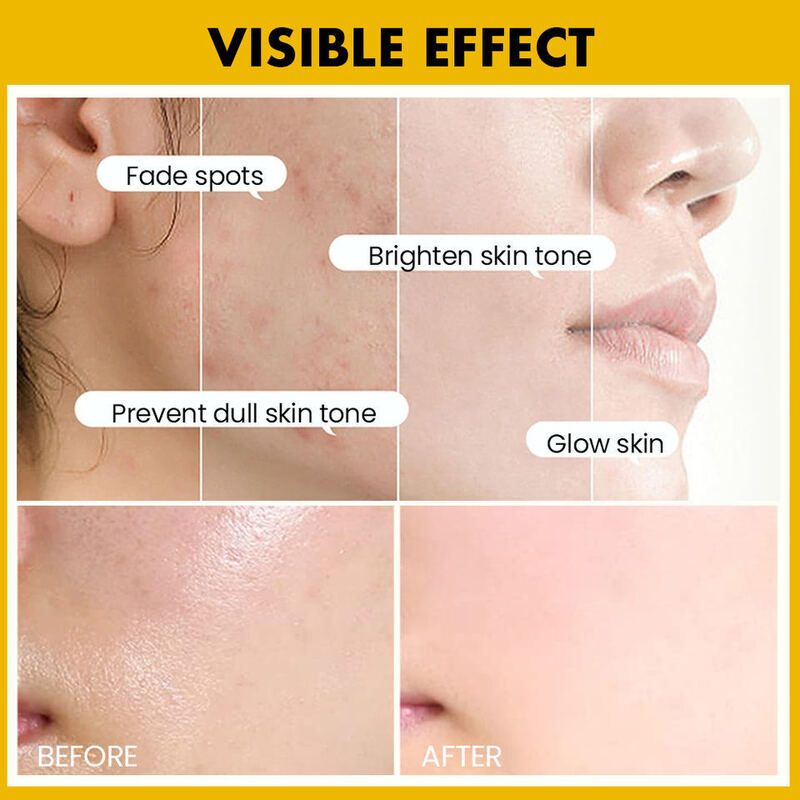 OEM ODM brand organic face cream Aloe based vitamin c facial moisturizing cream Black skin care quick whitening face cream Skin whitening