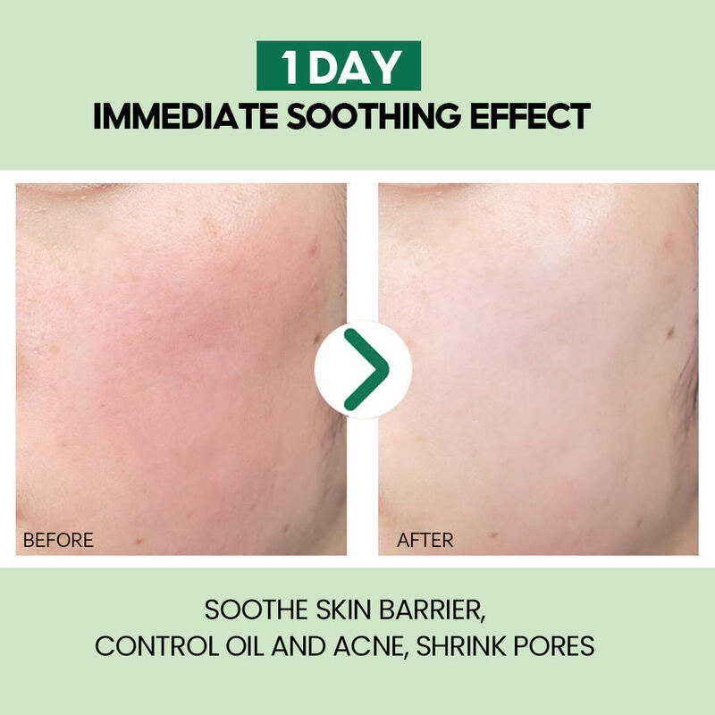 OEM ODM Korean Organic Facial Skin Care essence Facial Soothing Anti aging Aloe Vera Skin Care Product Facial Anti wrinkle Serum