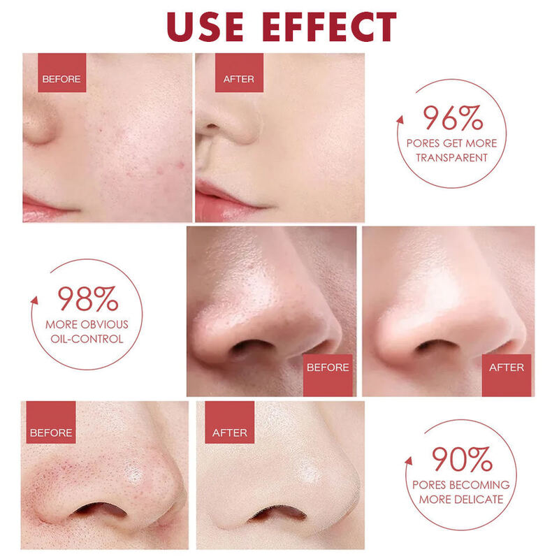 OEM ODM brand customized yeast water toner facial skincare advanced anti-aging repair acne cleaner skincare products facial toner