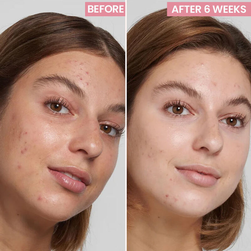 OEM ODM brand organic skincare hyaluronic acid vitamin C collagen anti-aging whitening facial serum moisturizing glow facial serum