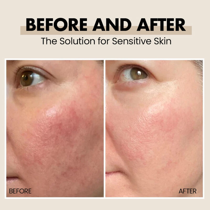 OEM ODM vegetarian skin care soothing facial essence repairing ruddy essence repairing firming soothing facial essence sensitive skin serum