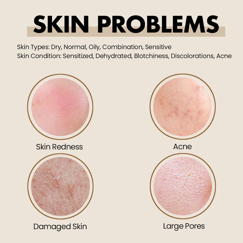 OEM ODM Organic Pure Element Korean Fragrance Toner Anti Allergy Advanced Redness Sensitive Skin Repair Moisturizing Facial Toner