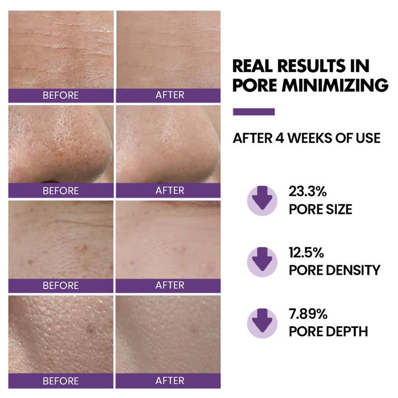 OEM ODM Deep Cleaning Exfoliating Facial Cleanser Hyaluronic Acid based Pore Minimization Hard Pore Cleanser