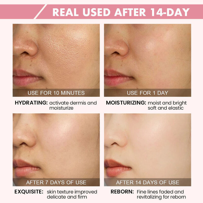 OEM ODM Korean skin care brand set Organic anti-aging face cream whitening rose facial essence serum vitamin c anti-aging luminous facial toner cleanser