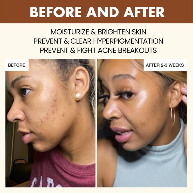 OEM ODM Brand Black Skin Brightening Toner Acne Treatment Pores Minimize Exfoliation Skin Glow Caramel Facial Toner spray