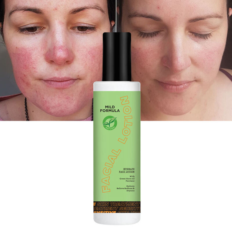 OEM ODM Brand Customized Organic Anti allergic Moisturizing Repair Facial lotion Moisturizing Cream Sensitive Skin Care Facial Skin Care Product Moisturizing Cream