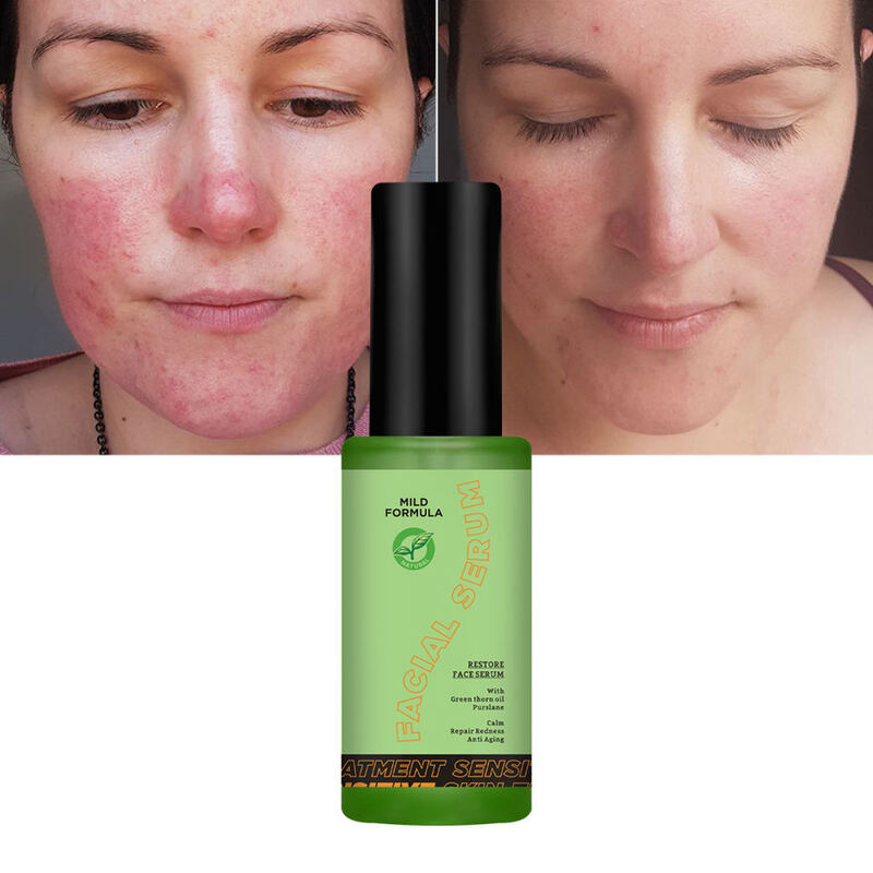 OEM ODM Brand Organic Vegetarian Serum essence Skin Care Soothing Anti Allergic Facial essence Calming&Repairing Redness essence Liquid for Sensitive Skin