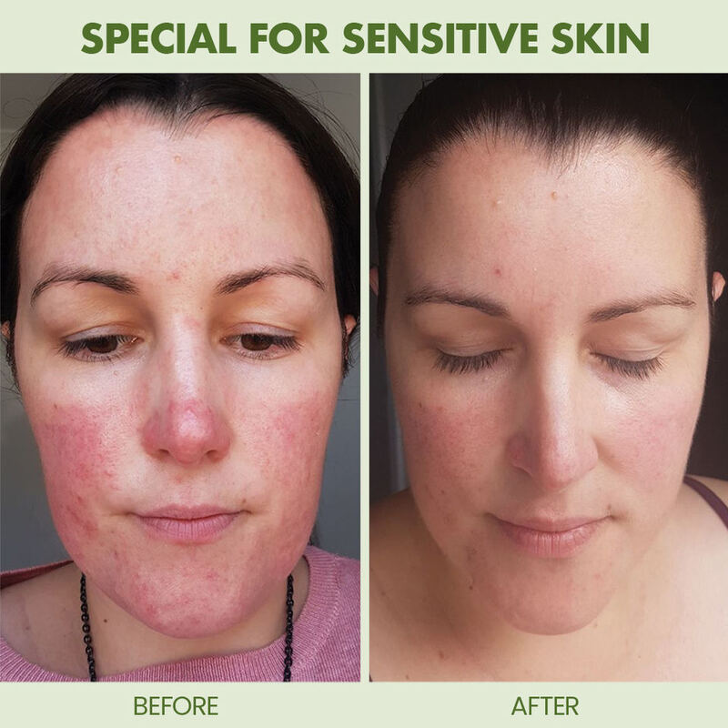 OEM ODM brand anti allergy moisturizing mild foam facial cleanser facial cleanser for sensitive skin