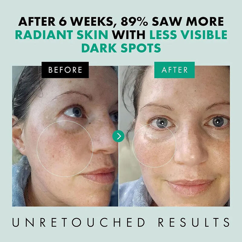 OEM ODM brand nicotinamide essence moisturizing anti-aging anti wrinkle whitening facial essence serum