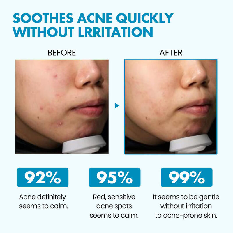 OEM ODM Aha Bha Pha face cream Acne Care Exfoliation Fast Calming Sensitive Whitening Skin Brand Facial Moisturizing face cream