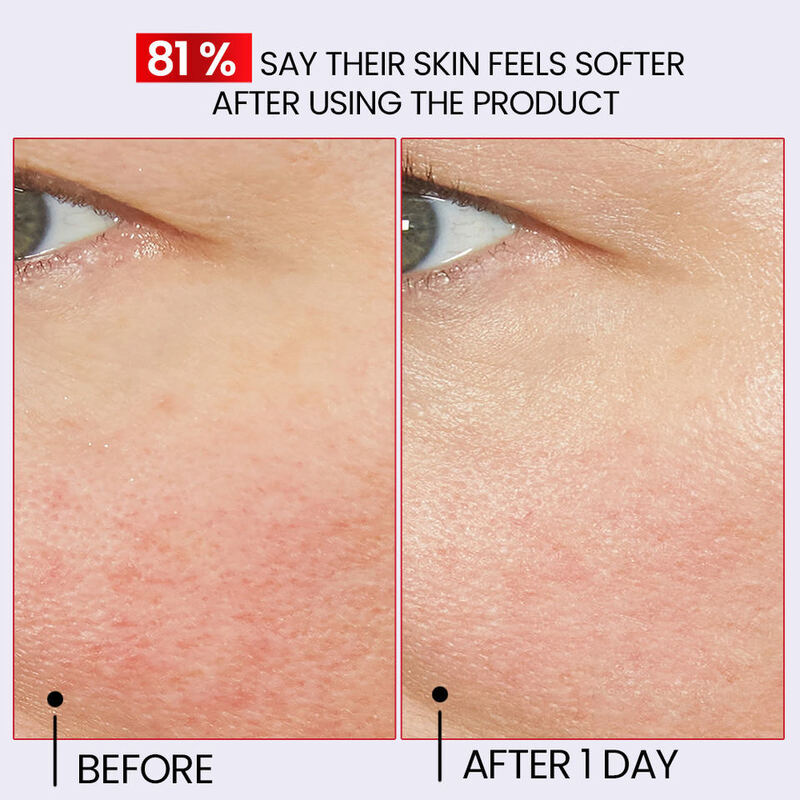 OEM ODM customized natural repair serum, organic skin care, redness, swelling, damage, relief, facial serum, facial essence