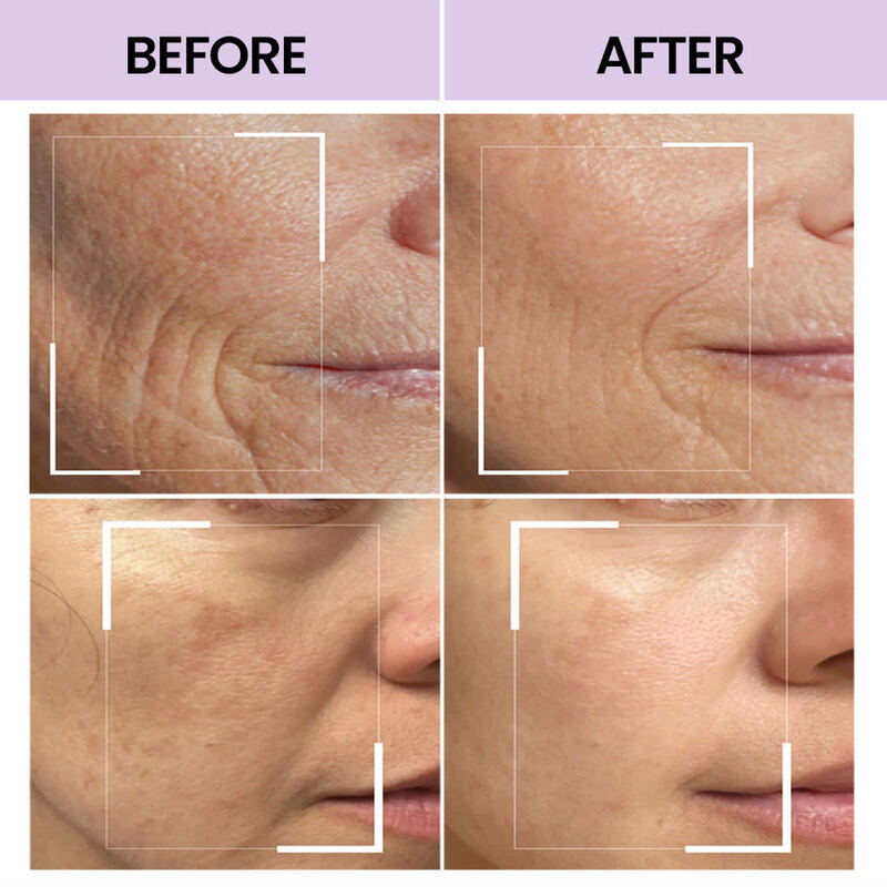 OEM ODM Natural Pure essence Repairing Acne Treatment Soothing Sensitive Skin Care Facial essence Facial essence Serum