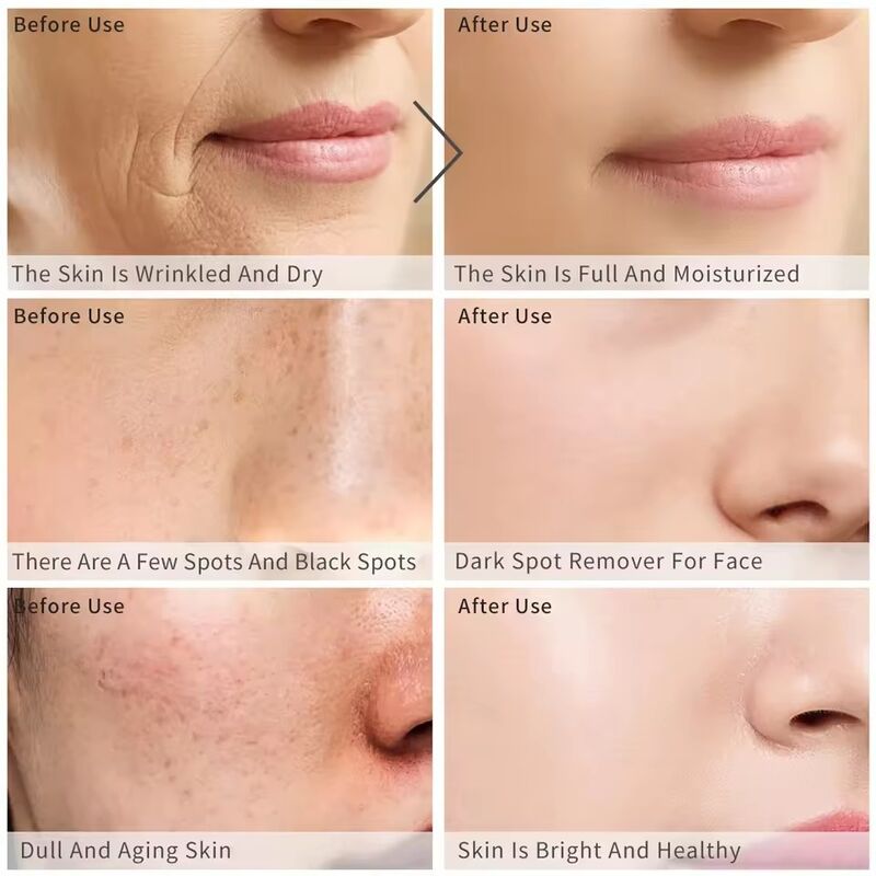 OEM ODM Brand Facial Serum Capsules Skincare Products Vitamin C Hyaluronic Acid Retinol Whitening and Anti Aging Serum Capsules