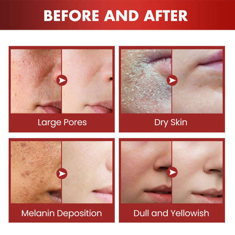 OEM ODM South Korean brand skin care set face cream manufacturer wholesale dragon blood moisturizing essence serum repair wrinkle skin care product moisturizing cream body lotion