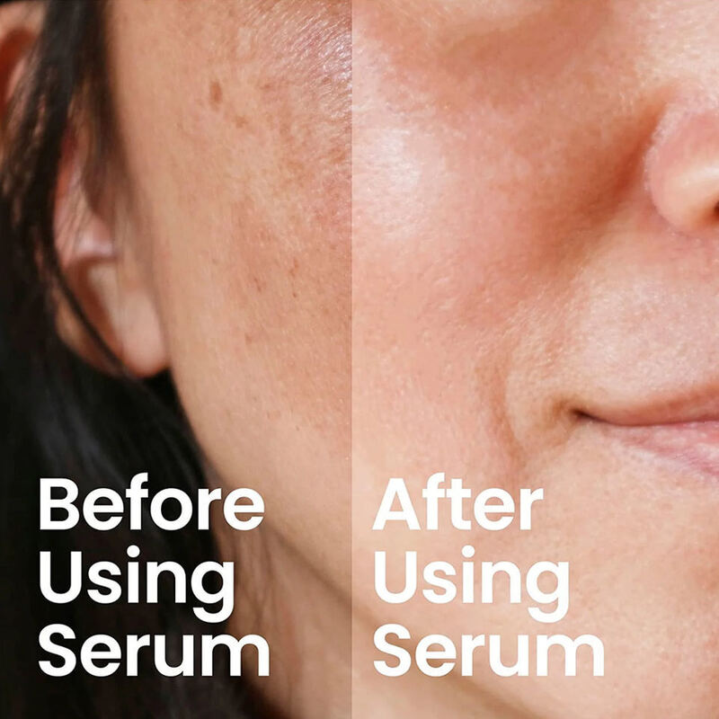 OEM ODM skin care five in one essence natural 30% vitamin C whitening hyaluronic acid anti-aging facial essence niacinamide collagen facial essence
