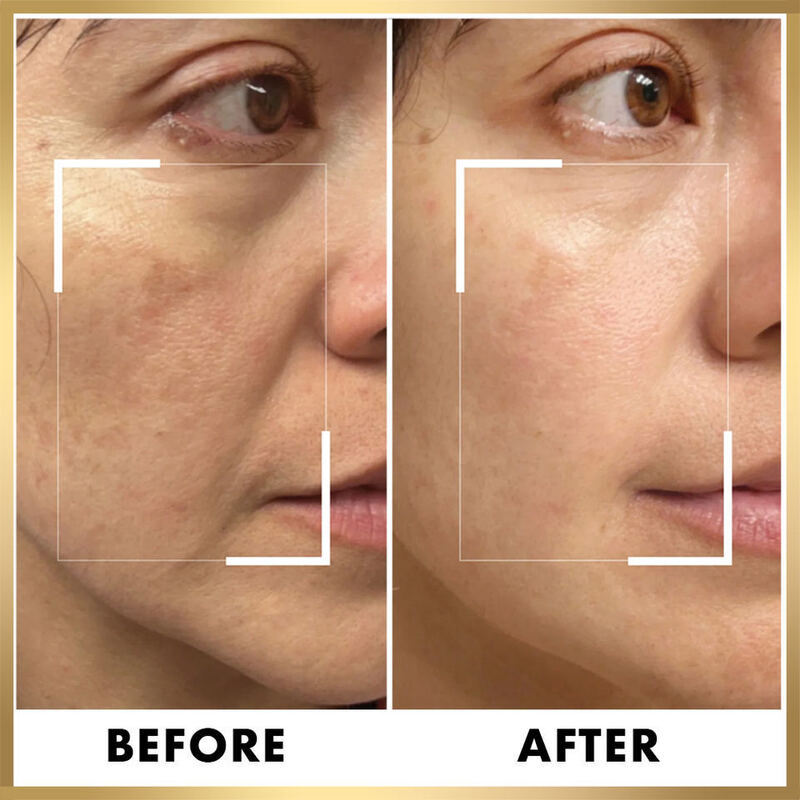 OEM ODM skin care essence private brand anti-aging anti wrinkle moisturizing 24k golden essence