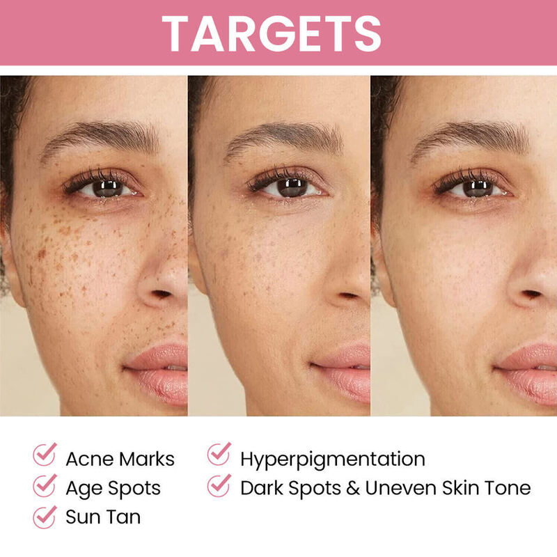 OEM ODM Korean skin care face cream whitening alpha arbutin whitening face cream black skin whitening anti-aging face cream