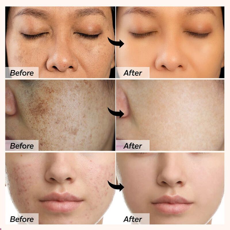 OEM ODM Wholesale Customized Best Cosmetic Organic Facial Cleanser Whitening Kojic Acid Facial Cleanser Private Brand Healthy foam Facial Cleanser